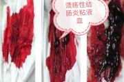 便血的原因,儿童便血的原因 便血的原因,儿童便血的原因