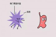 幽门杆菌如何检测幽门杆菌怎么检测方法