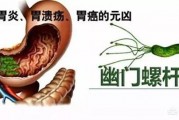 什么东西是胃最怕的？胃不好时，我们该如何养胃？