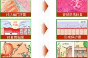 胃幽门螺旋杆菌是什么原因造成的传染吧胃幽门螺旋杆菌是什么原因造成的