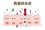 肠痉挛症状痉挛吃什么药效果好 肠痉挛症状痉挛吃什么药效果好
