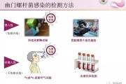 幽门螺旋杆菌哪里可以检查的简单介绍