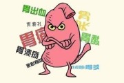 胃十二指肠溃疡的症状及治疗胃溃疡症状