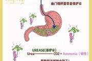 幽门螺旋杆菌感染怎么引起的幽门螺旋杆菌感染怎么治疗