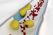 12种降低胆固醇的食物胆固醇高的原因