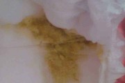 关于拉肚子拉的全是黄稀水肚子还咕咕叫的信息