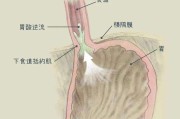 胃内容物和呕吐物的区别胃内容物 胃内容物和呕吐物的区别胃内容物