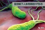 幽门螺旋杆菌阳性2是什么意思的简单介绍