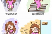尿失禁尿失禁吃什么药