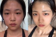 减肥后的皮肤松弛怎么办,减肥后的皮肤