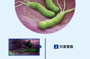 幽门螺旋杆菌感染后多久复查幽门螺旋杆菌感染有哪些症状多长时间复查