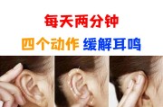 耳保健操能提高听力吗耳保健操 耳保健操能提高听力吗耳保健操