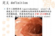 十二指肠溃疡和胃溃疡区别十二指肠溃疡