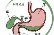 为什么胆汁反流病晚上会严重,胆汁反流性胃炎吃什么药
