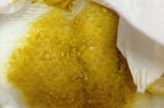 蒙脱石散,宝宝肠胃炎 蒙脱石散,宝宝肠胃炎