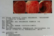 睡醒来胃痛是什么原因? 睡醒来胃痛是什么原因?