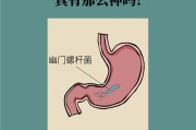 怎样检查幽门螺杆菌?,怎样检查幽门螺杆菌