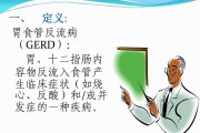 胃食道反流一招治好胃食管反流病症状