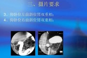 消化道造影消化道造影是什么造影