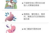 胃镜检查注意事项,超声胃镜检查注意事项
