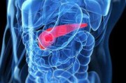 胰腺癌,胰腺癌晚期最怕三个征兆
