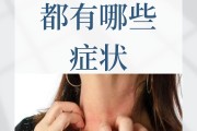 甲醛超标会怎样甲醛超标会怎样处理 甲醛超标会怎样甲醛超标会怎样处理