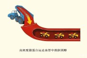总胆固醇正常值总胆固醇正常值偏高