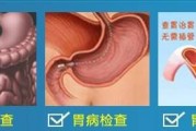 胃部幽门螺旋杆菌什么症状啊的简单介绍