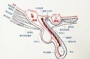 腹股沟疝气最简单的消除方法,腹股沟