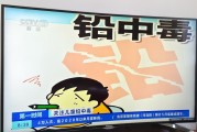 儿童铅中毒,儿童铅中毒牙龈图片 儿童铅中毒,儿童铅中毒牙龈图片