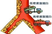 载脂蛋白a偏高血清载脂蛋白a偏高怎么治疗