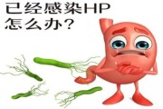 幽门螺杆菌感染有哪些症状,胃部感染幽门螺旋杆菌有什么症状