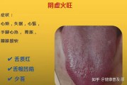 入睡困难是心火还是肝火,阴虚火旺型失眠的症状