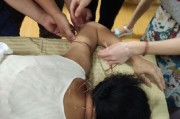 针灸教学视频140集免费针灸教学视频140集免费百度云