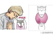 甲亢症状有哪些症状,甲亢症状有哪些症状怎么治疗