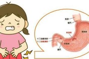 胃溃疡什么症状,十二指肠溃疡症状表现有哪些 胃溃疡什么症状,十二指肠溃疡症状表现有哪些