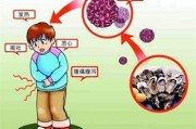 上吐下泻怎么回事上吐下泻是什么病情 上吐下泻怎么回事上吐下泻是什么病情