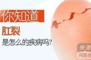 轻微肛裂多少天能自愈,肛裂