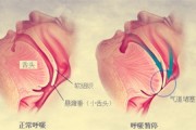 为什么睡觉突然开始打鼾了,睡觉突然打鼾是什么原因