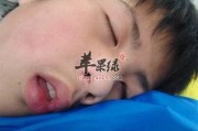 睡觉爱流口水是什么病症睡觉爱流口水是什么病