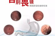 无痛胃镜检查,无痛胃镜检查后需要注意什么 无痛胃镜检查,无痛胃镜检查后需要注意什么