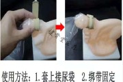小便失禁是什么原因引起的 怎样治小便失禁