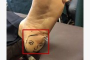 鬼门十三针真能治精神病吗,鬼门十三针的功效与作用