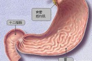 什么是十二指肠胃反流? 什么是十二指肠胃反流?