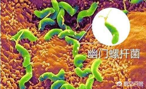幽门螺杆菌是什么<strong>胃溃疡</strong>？