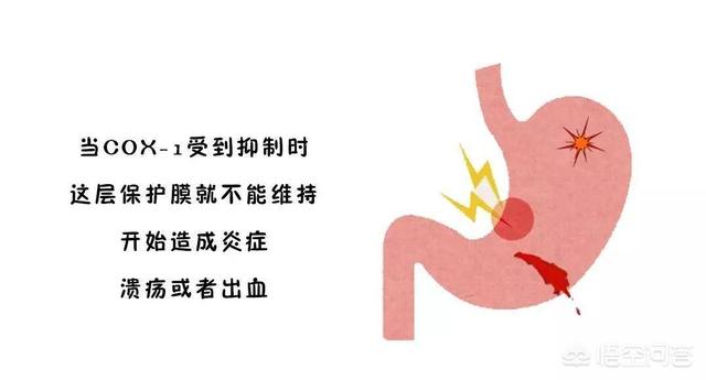 胃溃疡喜欢“缠上”这3类人<strong>胃溃疡</strong>，是指哪三类人？