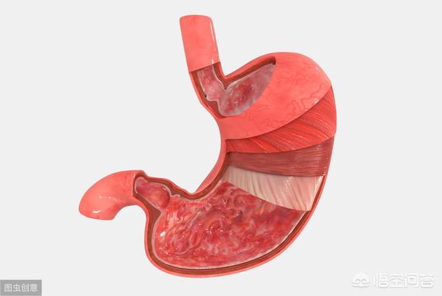 消化科医生：日常养胃5大“禁忌”<strong>健胃</strong>，千万要戒掉，分别有哪5大禁忌？如何养胃？