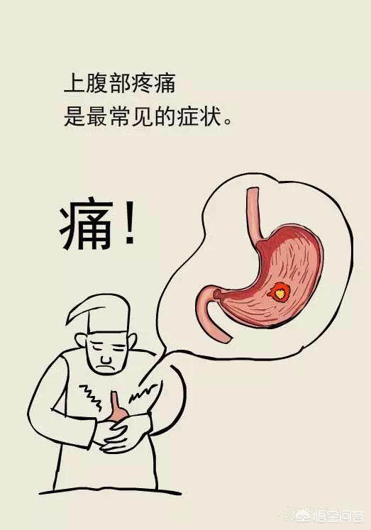 十二指肠球炎吃什么药<strong>十二指肠</strong>？