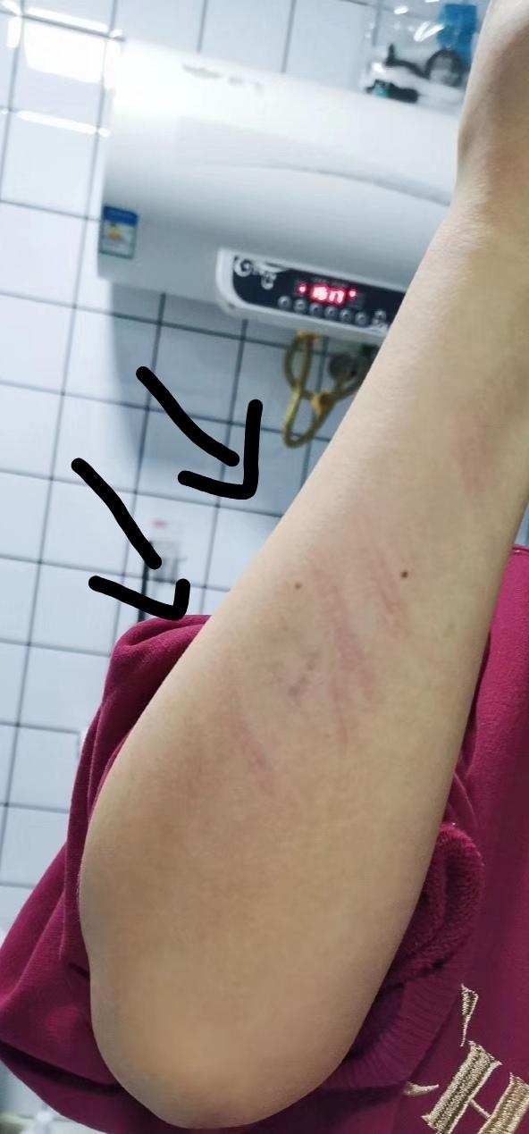 跳绳<strong>跳绳减肥</strong>，肥肉会变肌肉吗？每天跳到出汗能有效瘦吗？