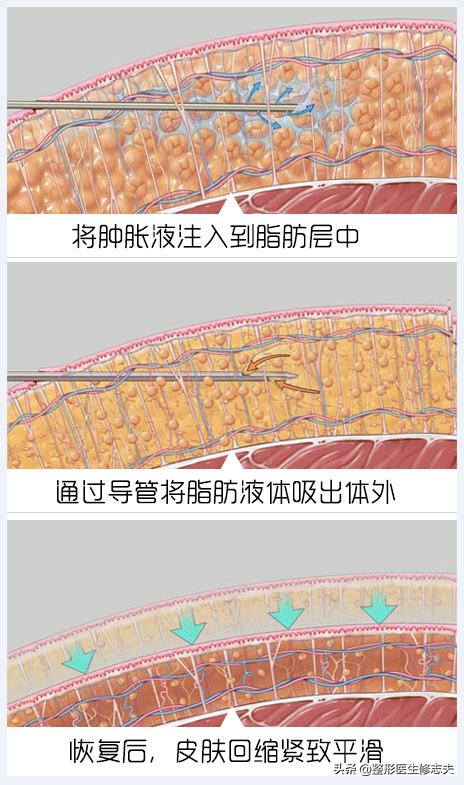 如何轻松减脂<strong>减肥</strong>？